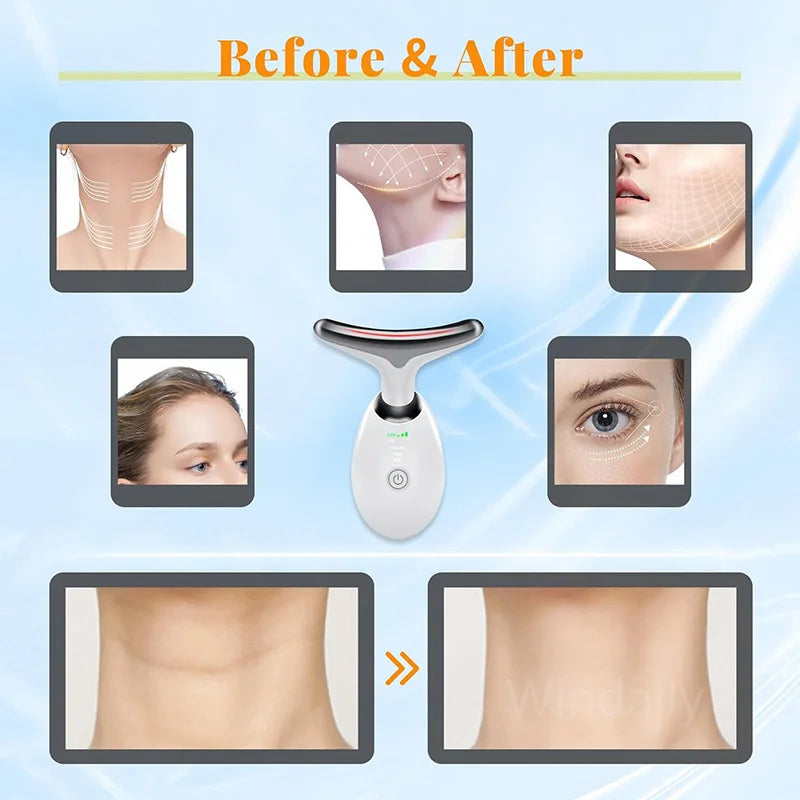 7 Colors Anti Wrinkle Facial Massager
